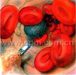 納米機(jī)器人在清理血管中的有害堆積物