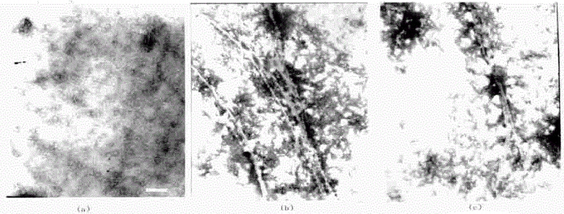 肌動蛋白復(fù)合纖維透射電鏡圖
